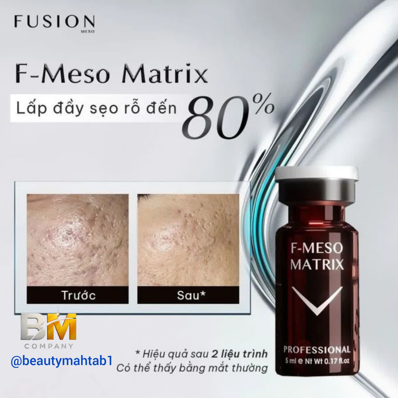 مزو ماتریکس فیوژن