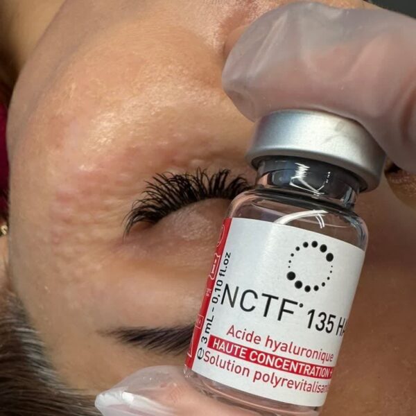 مزو دور چشم NCTF 135 HA